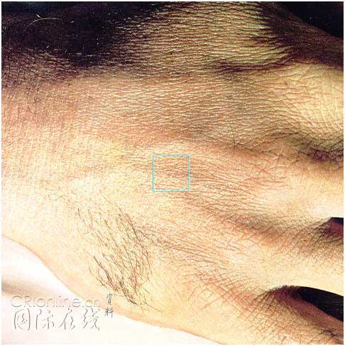 [转帖]方寸肌肤的微观世界