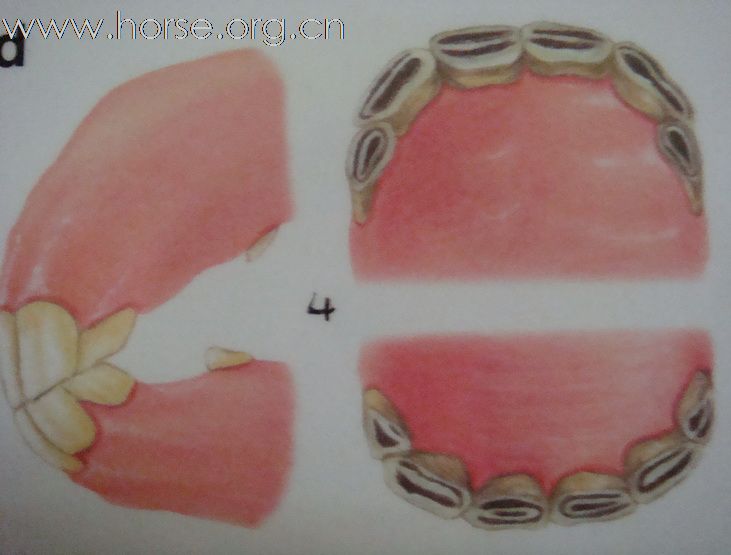 观牙齿辨马龄图片一览（4—7岁）