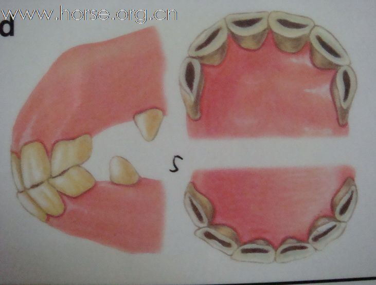 观牙齿辨马龄图片一览（4—7岁）