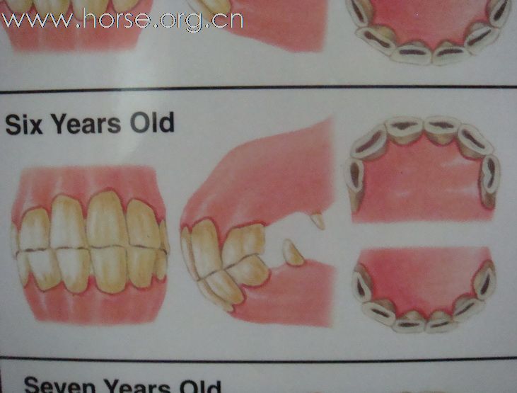 观牙齿辨马龄图片一览（4—7岁）